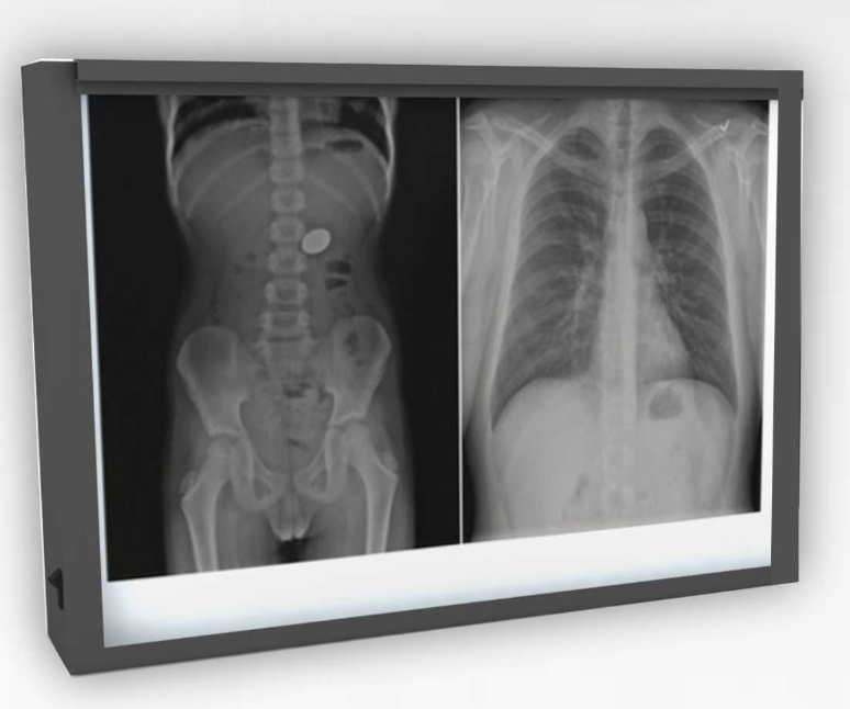 X-Ray Film Viewing Screen